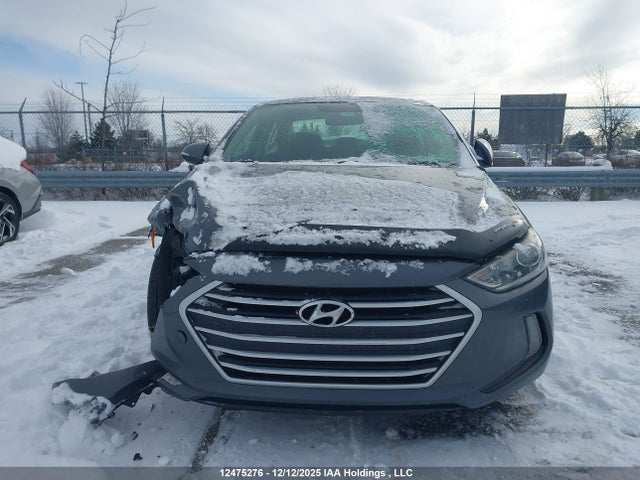 KMHD84LF6HU399644 Hyundai Elantra