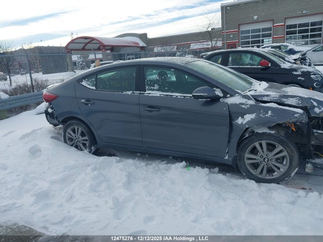 KMHD84LF6HU399644 Hyundai Elantra