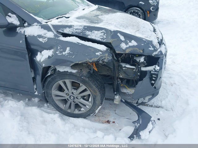 KMHD84LF6HU399644 Hyundai Elantra