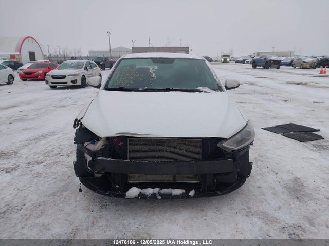KMHD84LF6JU668991 Hyundai Elantra Sel/value/limited