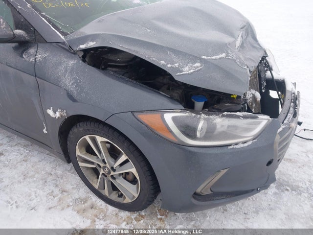 KMHD84LF5JU477725 Hyundai Elantra Sel/value/limited