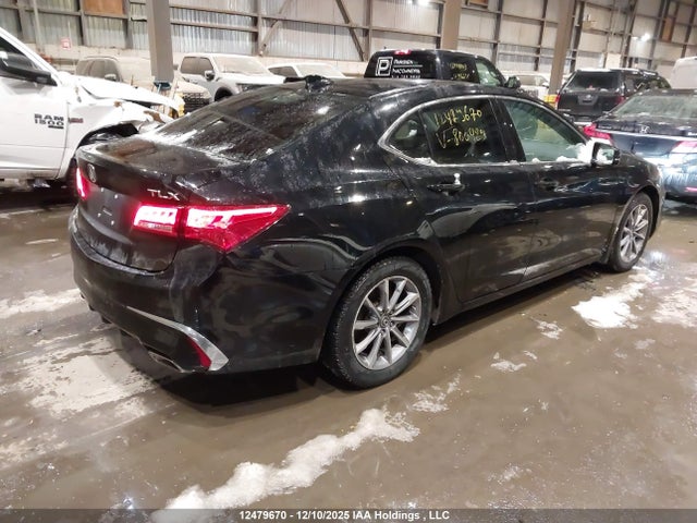 Acura TLX 2019 19UUB1F34KA800429 Image 4