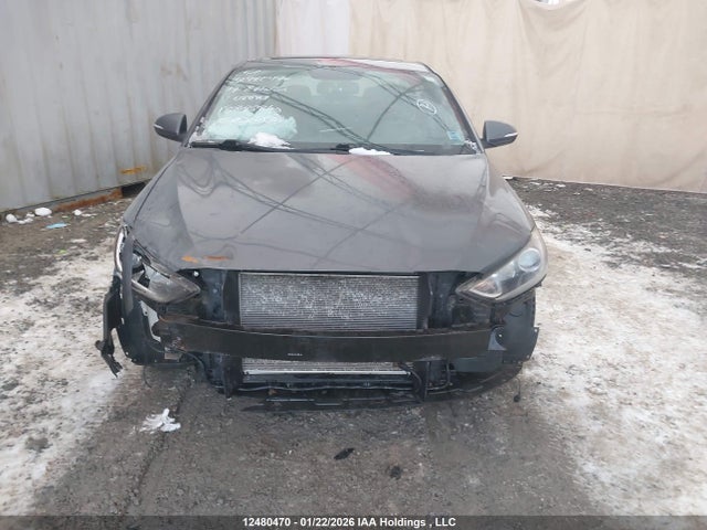 KMHD84LF6HU088909 Hyundai Elantra Se/value/limited