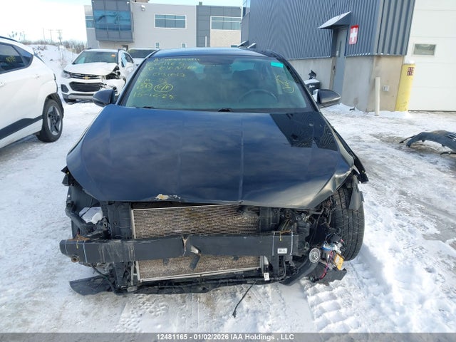 KMHD84LF1LU091015 Hyundai Elantra Sel/value/limited