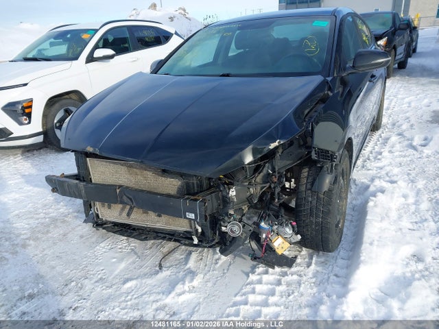 KMHD84LF1LU091015 Hyundai Elantra Sel/value/limited