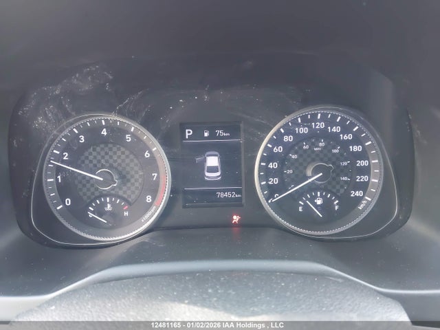 KMHD84LF1LU091015 Hyundai Elantra Sel/value/limited