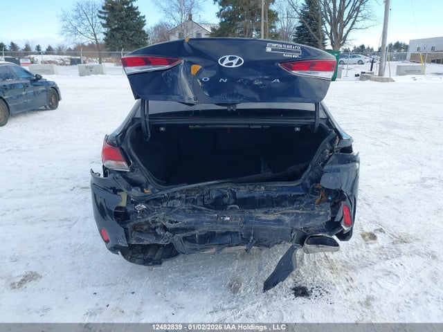 5NPE34AF2JH615502 Hyundai SONATA GLS