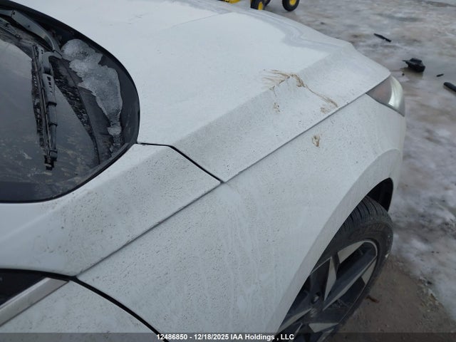 KMHLN4AJ6PU066855 Hyundai Elantra Limited