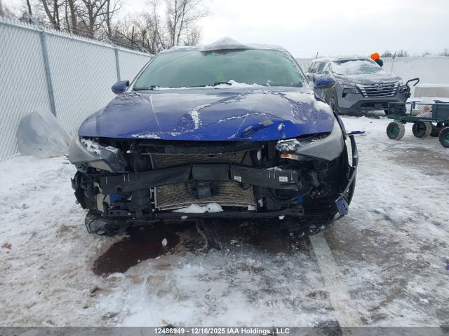 KMHLN4AGXNU317121 Hyundai Elantra