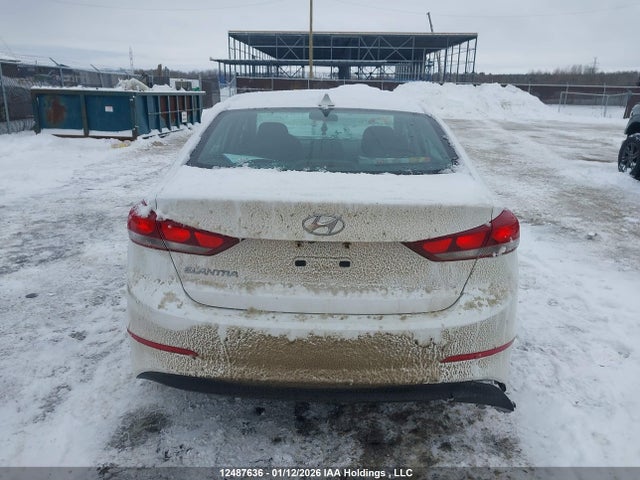 KMHD84LF6HU419858 Hyundai Elantra Se/value/limited