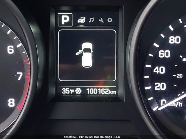 5XYZT3LB0JG521051 Hyundai Santa Fe Sport 2.4 Base