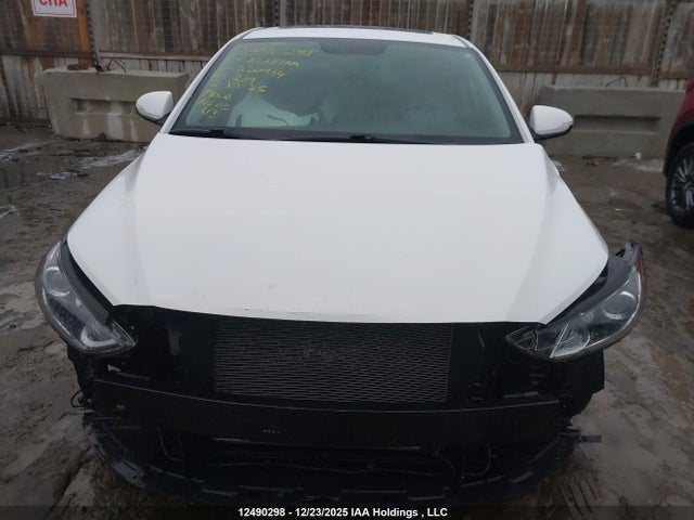 KMHD84LF4HU220954 Hyundai Elantra Se/value/limited