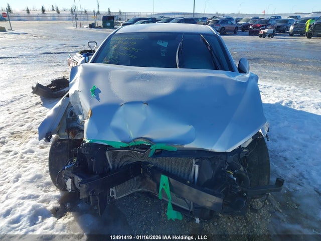 KMHD84LF2JU479495 Hyundai ELANTRA GL