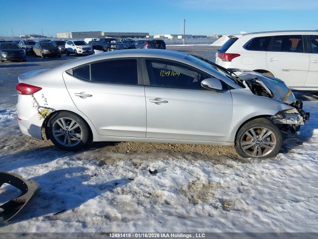 KMHD84LF2JU479495 Hyundai ELANTRA GL