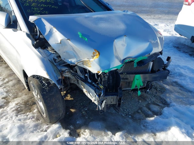 KMHD84LF2JU479495 Hyundai ELANTRA GL