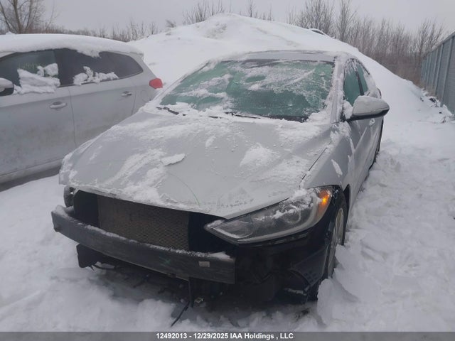 KMHD84LF5JU499420 Hyundai Elantra