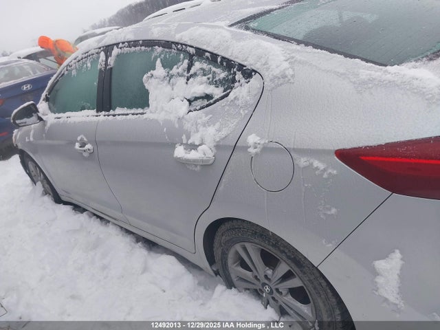 KMHD84LF5JU499420 Hyundai Elantra