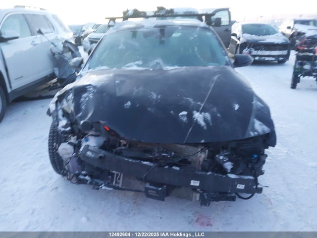 KMHLN4DJ2RU117461 Hyundai Elantra Limited