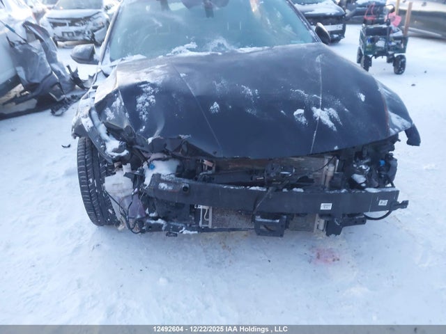 KMHLN4DJ2RU117461 Hyundai Elantra Limited