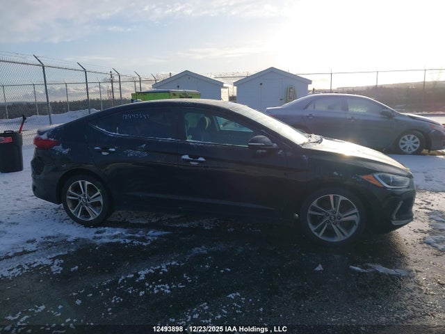 KMHD84LF7HU087073 Hyundai Elantra Se/value/limited