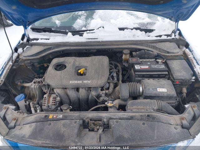 KMHD84LF1HU431593 Hyundai ELANTRA GL