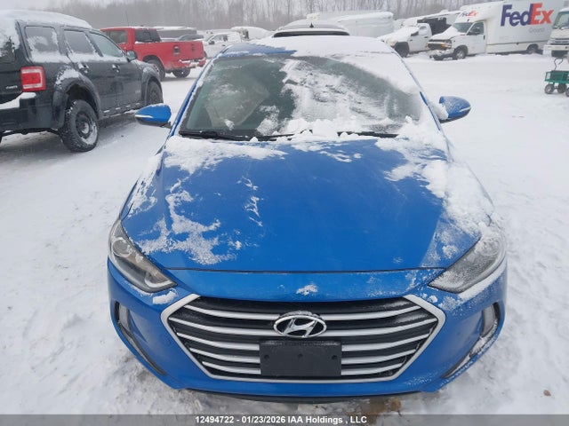KMHD84LF1HU431593 Hyundai ELANTRA GL