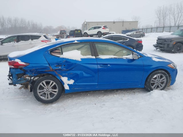 KMHD84LF1HU431593 Hyundai ELANTRA GL
