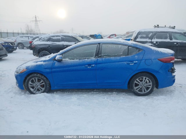 KMHD84LF1HU431593 Hyundai ELANTRA GL