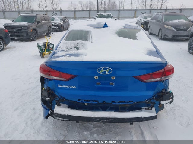 KMHD84LF1HU431593 Hyundai ELANTRA GL