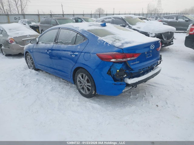 KMHD84LF1HU431593 Hyundai ELANTRA GL