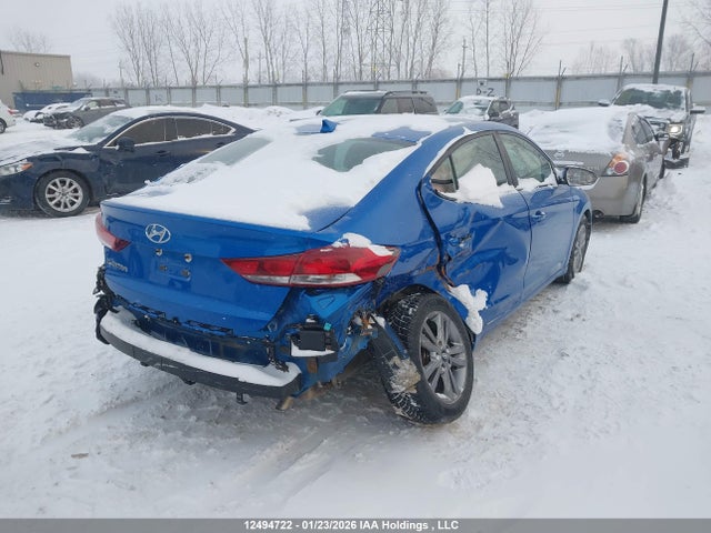 KMHD84LF1HU431593 Hyundai ELANTRA GL