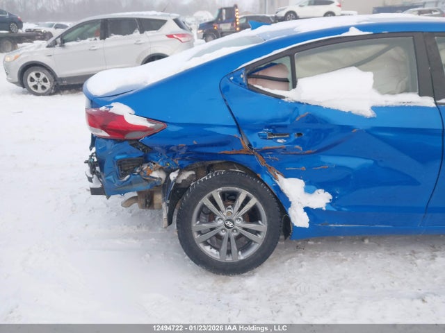 KMHD84LF1HU431593 Hyundai ELANTRA GL