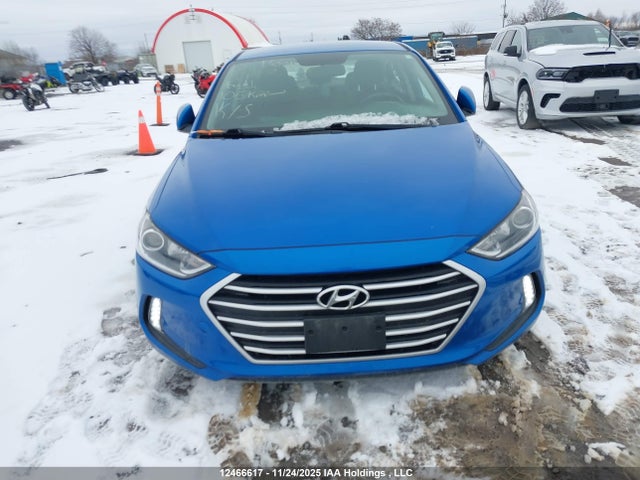 KMHD84LFXJU679766 Hyundai mpi nu