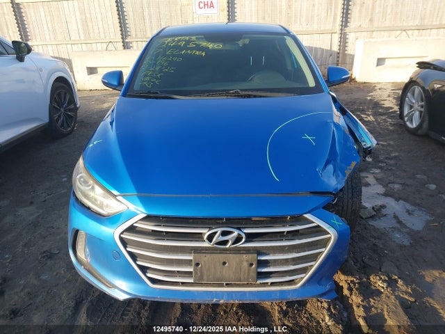 KMHD84LF8HU116290 Hyundai Elantra Se/value/limited