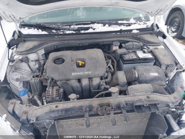 KMHD84LF1JU720107 Hyundai Elantra Gl Se