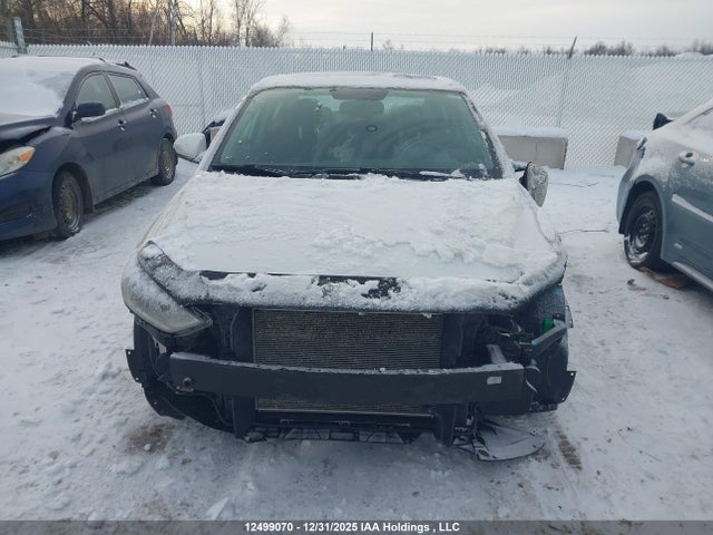 KMHD84LF1JU720107 Hyundai Elantra Gl Se