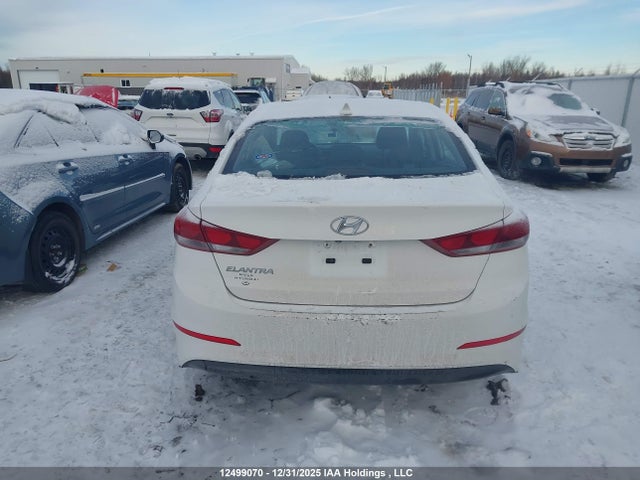 KMHD84LF1JU720107 Hyundai Elantra Gl Se