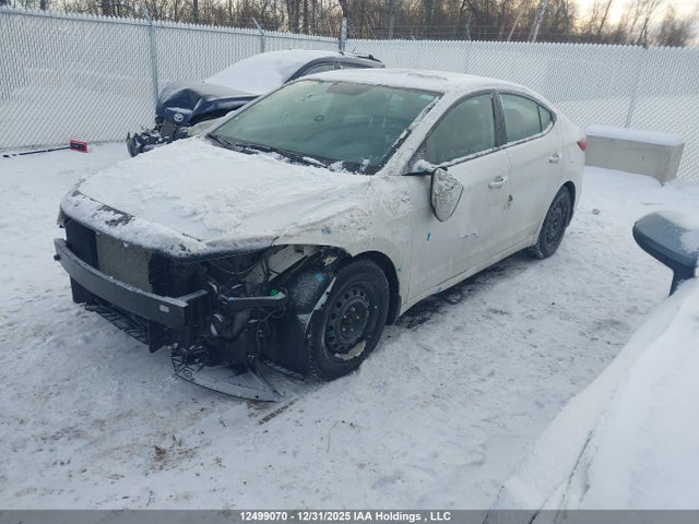 KMHD84LF1JU720107 Hyundai Elantra Gl Se