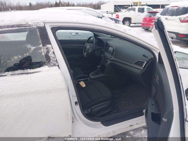 KMHD84LF1JU720107 Hyundai Elantra Gl Se
