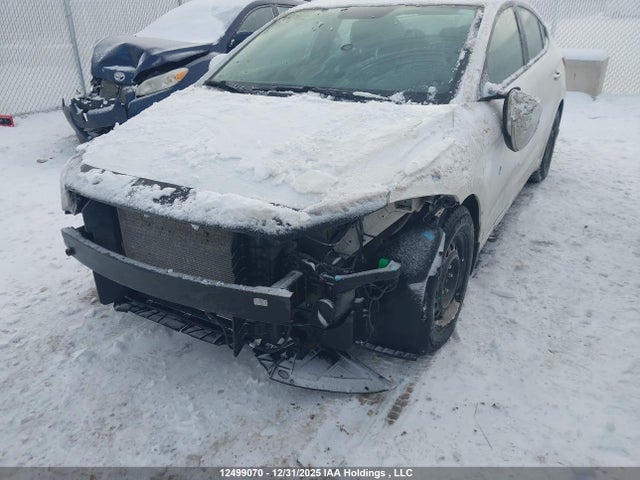 KMHD84LF1JU720107 Hyundai Elantra Gl Se