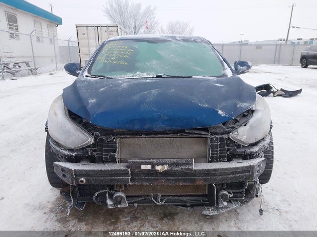 KMHDH4AH0FU236876 Hyundai Elantra Se/sport/limited