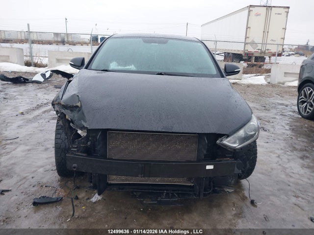 12499636 :رقم المزاد ، KMHD84LF9JU581506 vin ، 2018 Hyundai Elantra Gl مزاد بيع