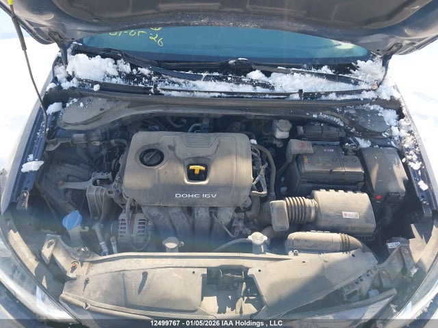 KMHD84LFXHU403985 Hyundai Elantra Gls