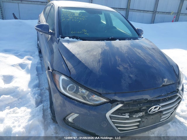 KMHD84LFXHU403985 Hyundai Elantra Gls