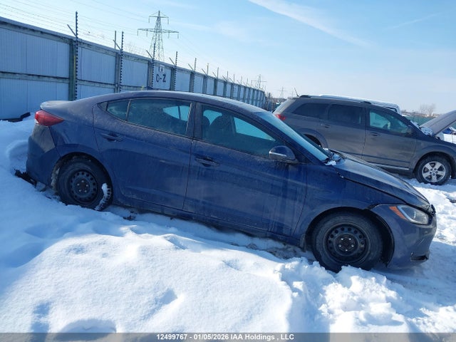 KMHD84LFXHU403985 Hyundai Elantra Gls