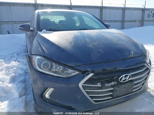 KMHD84LFXHU403985 Hyundai Elantra Gls
