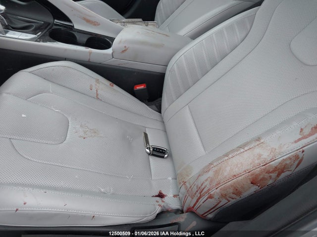 KMHLN4AG5PU628393 Hyundai Elantra