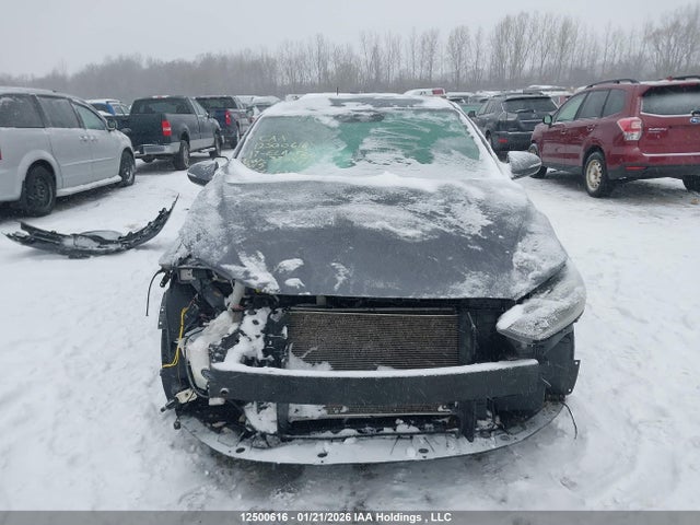 KMHD84LF2HU375471 Hyundai Elantra Se/value/limited
