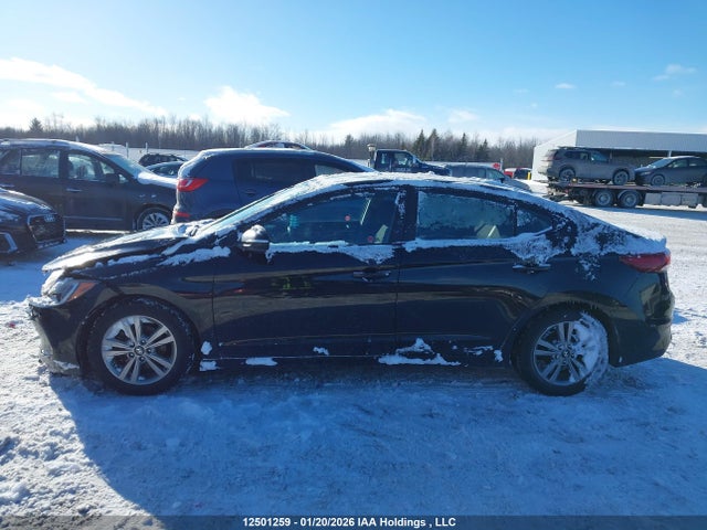 KMHD84LF8JU644210 Hyundai ELANTRA GL