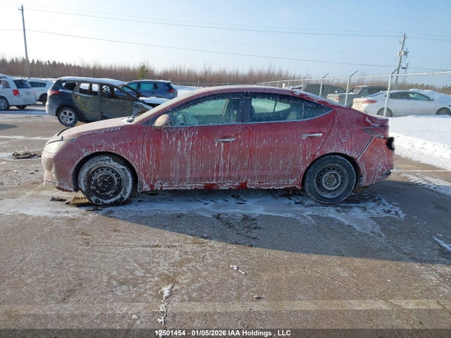 KMHD84LF2LU110073 Hyundai Elantra Luxury